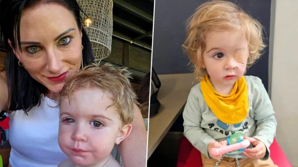 Copil de 2 ani orb la un ochi după ce a fost sărutat de un infectat cu herpes! Detalii șocante